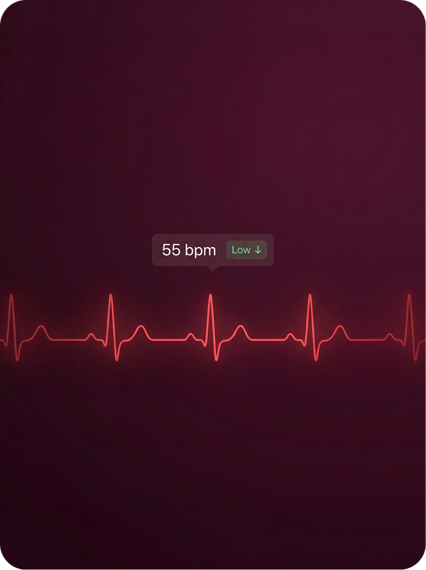 See your baseline shift over time